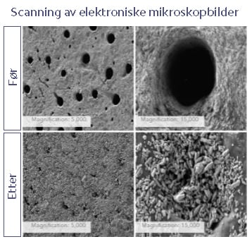 Scanning av elektroniske mikroskopbilder